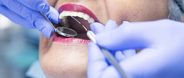 Best Emergency Dentist for Lost Fillings or Crowns in Lumber City, GA